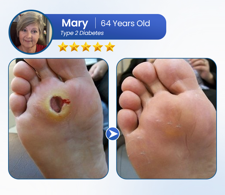 BQYOOM™ AngioVita Diabetic Care Spray