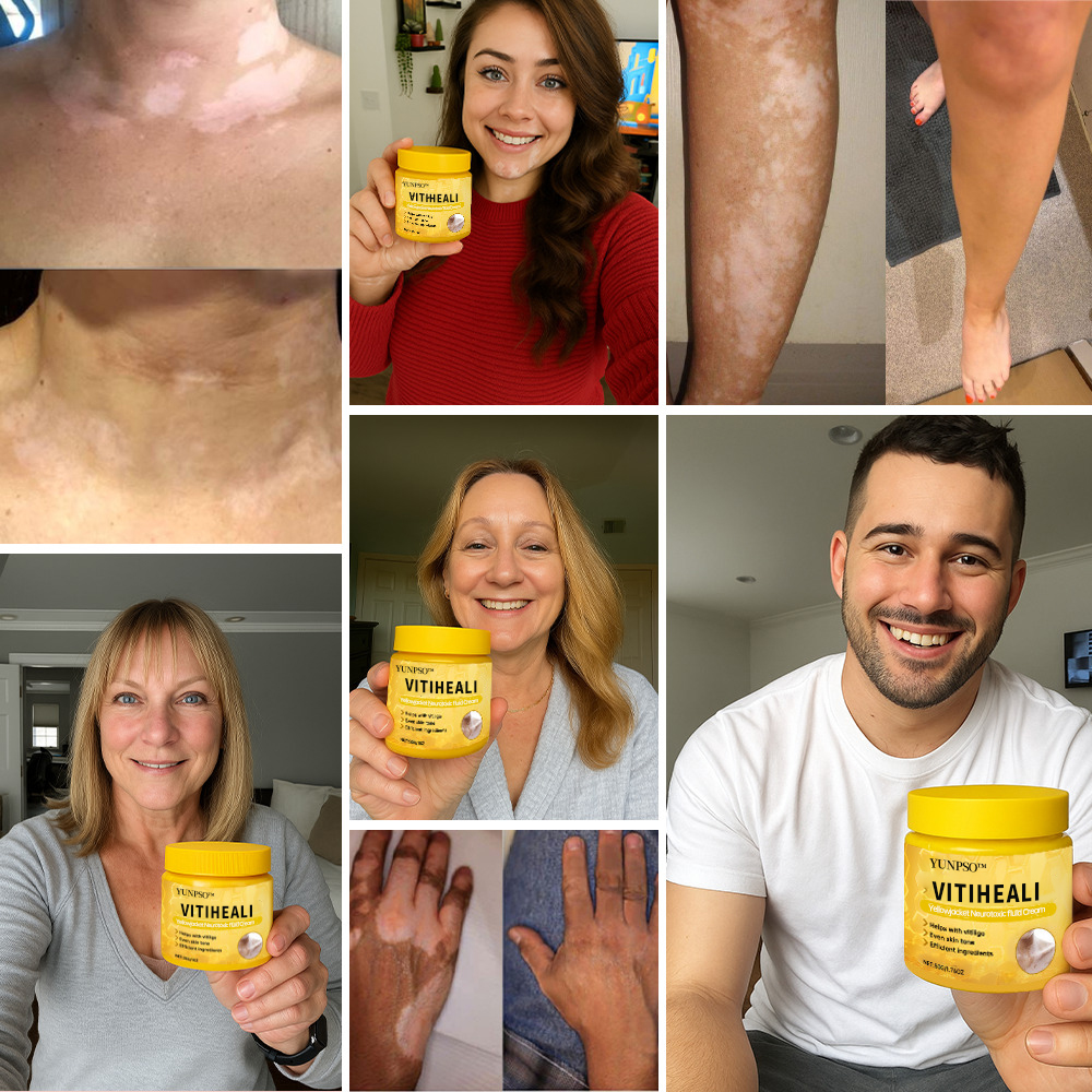 YUNPSO® VitiHeali Yellowjacket Neurotoxic fluid Extractm Cream Ultra 24 YUNPSO® VitiHeali Yellowjacket Neurotoxic fluid Extractm Cream Ultra