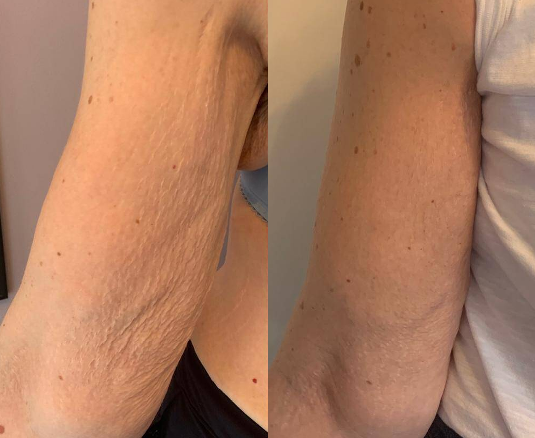 NATRAVOR® AuréLuxe Body Firming Oil image NATRAVOR® AuréLuxe Body Firming Oil