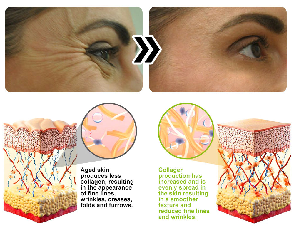 Zvoevo® VitaBotox Firming Elixir combines Botox 40 042d849bb60559c9d3afd6d8e4404b1e