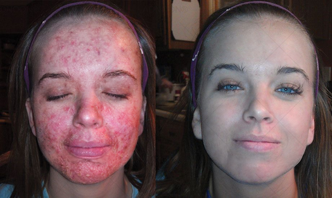 BBOJI™ 7-Day Multi-Effect All-in-One Skincare Cream image BBOJI™ 7-Day Multi-Effect All-in-One Skincare Cream