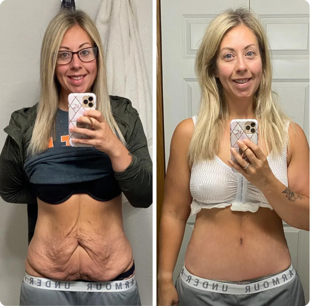 Zvoevo® VitaBotox Firming Elixir combines Botox 46 057646e44d399e5961e0e19bbaf70939