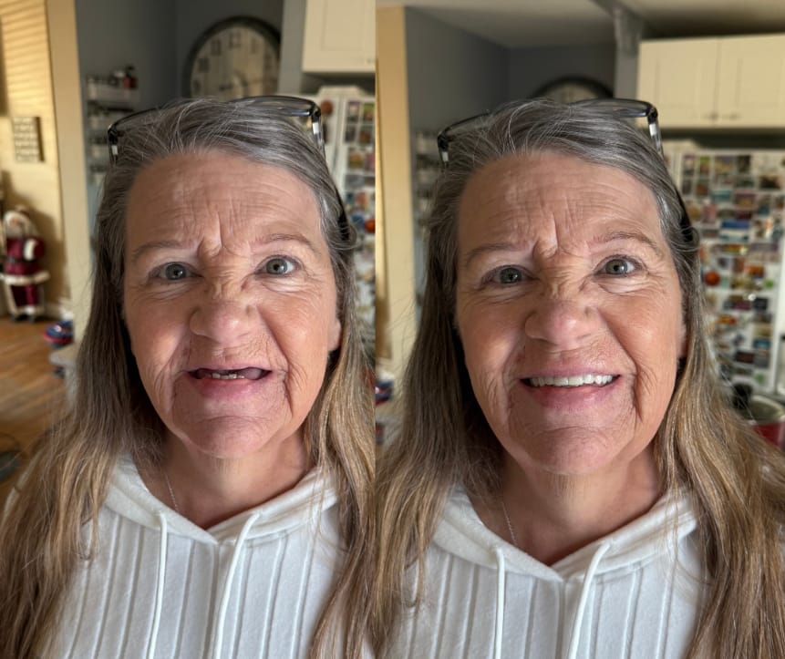 Marilyn Tate review of EcoSmark GelFit Dentures – Made in the USA & FDA-Certified