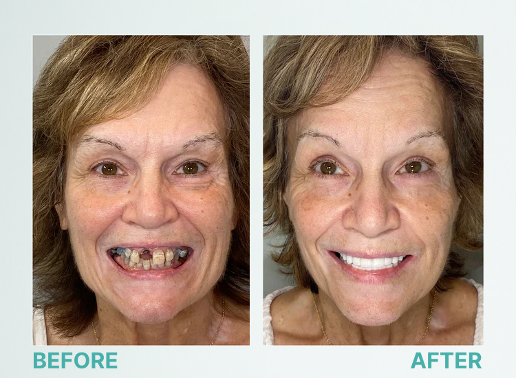 09dfb51d6b61a3655cfed71e02f85f8f