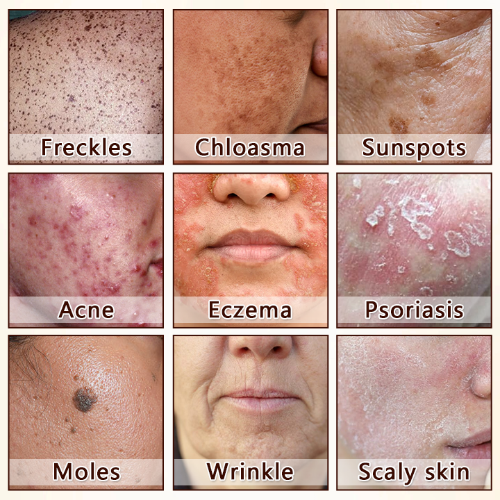 Biancat® Bee Venom Multi-Repair Cream