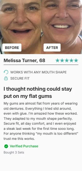 Melissa Turner Before After