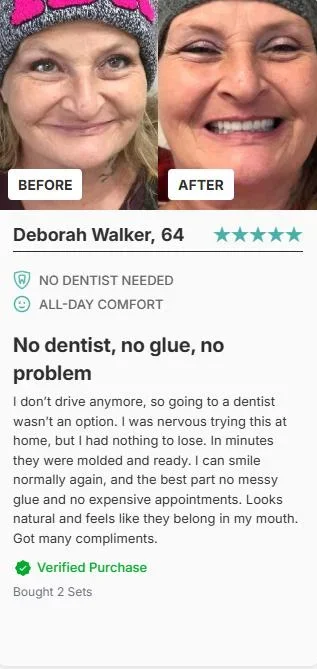 BRONY™ Custom-Fit Full Functional Dentures Make you more confident