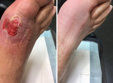 HZA™ FungiVanish Foot Treatment Spray