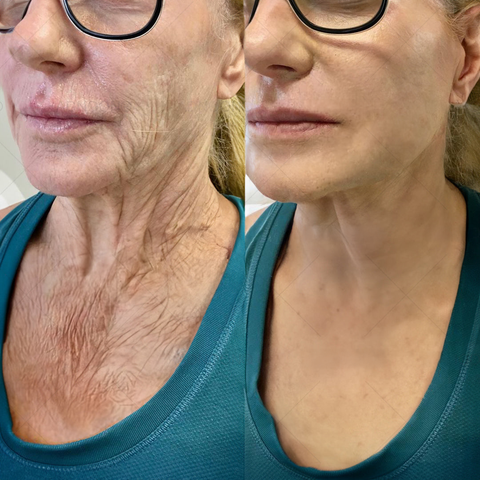 BBOJI™ 7-Day Multi-Effect All-in-One Skincare Cream image BBOJI™ 7-Day Multi-Effect All-in-One Skincare Cream