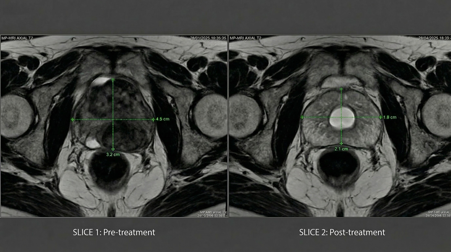 ROSOPL VitalEngine Pro 24 1e5b958357967d7d4a3f4d9cb1edc559