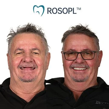 ROSOPL™ Functional Dentures – Dentist Recommended for Seniors 45+ | Made in USA | FDA Cleared