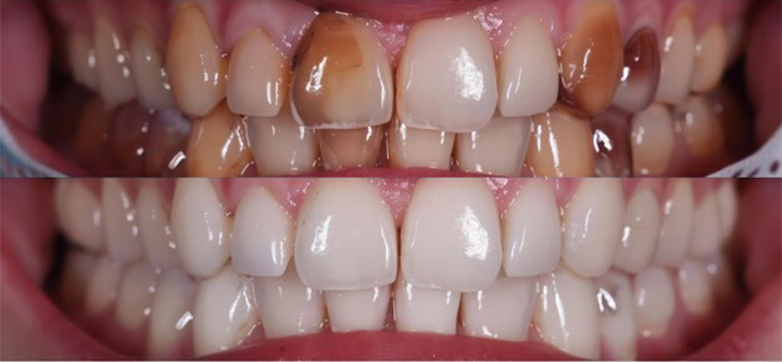 Rosopl® Multi-Action Oral Care Essence image Rosopl® Multi-Action Oral Care Essence