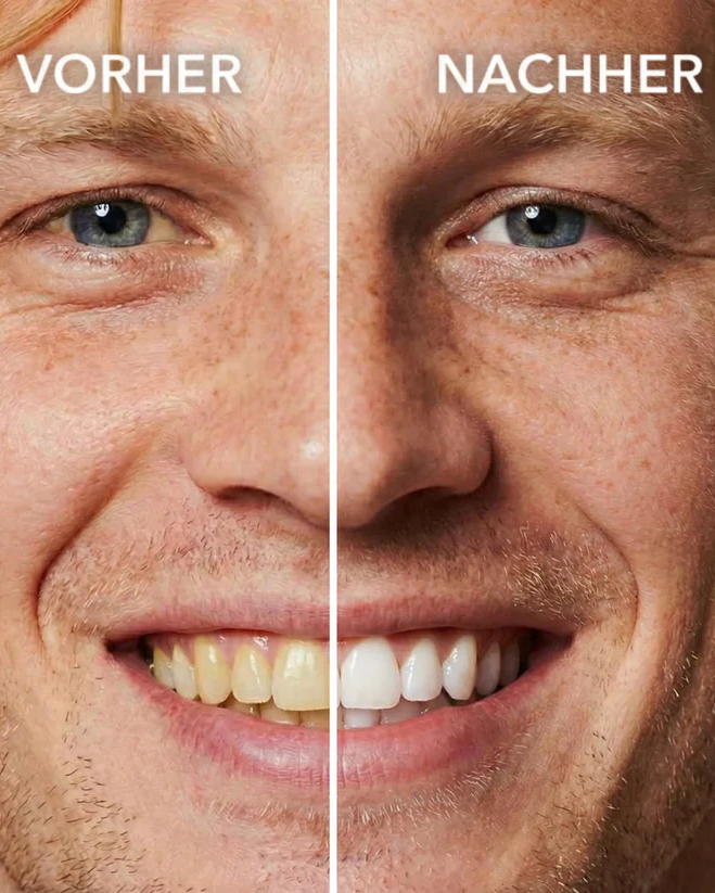 Miraloud™ Tooth Polish - Instant Clean Smile