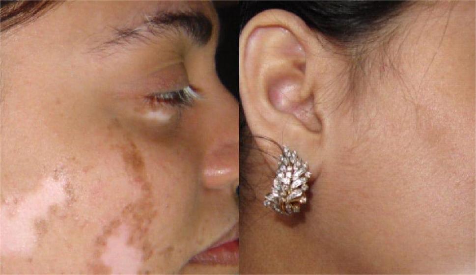 YUNPSO® VitiHeali Yellowjacket Neurotoxic fluid Extractm Cream Ultra 26 YUNPSO® VitiHeali Yellowjacket Neurotoxic fluid Extractm Cream Ultra