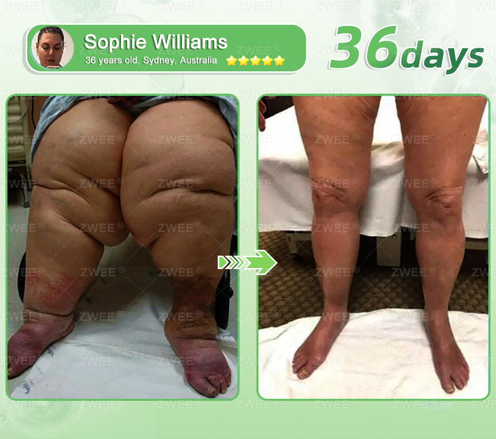 ZWEE® GLP-1 7-Day Gut Cleanse & Slim Support Oral Solution