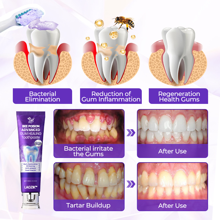 LAOZIK™ Bee Poison Advanced Gum Healing Toothpaste 30 26b717958aa7b1267bc16ccaf1332020