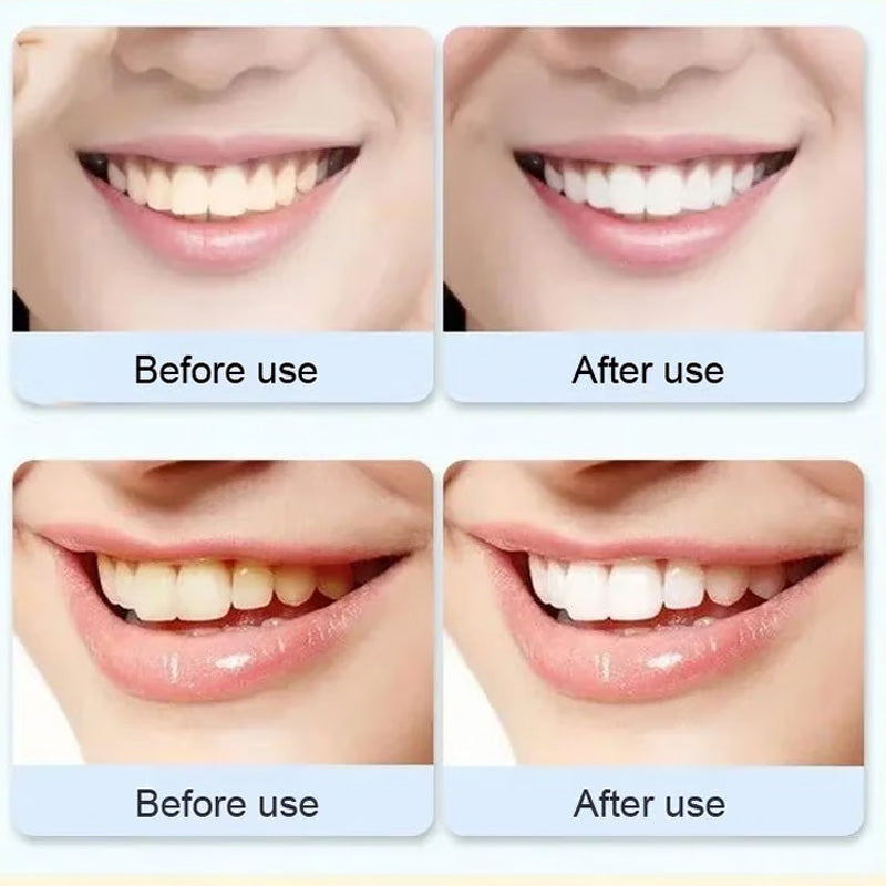 Probiotic whitening toothpaste