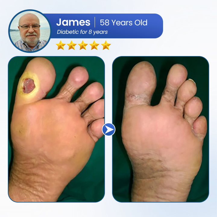 BQYOOM™ AngioVita Diabetic Care Spray