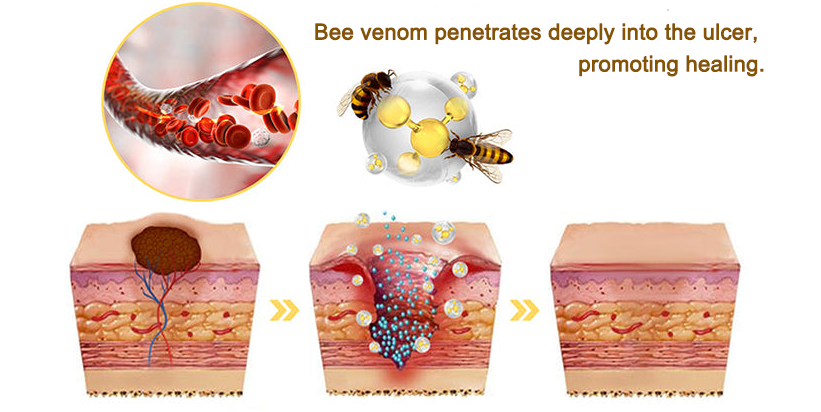 HZA™ FungiVanish Foot Treatment Spray