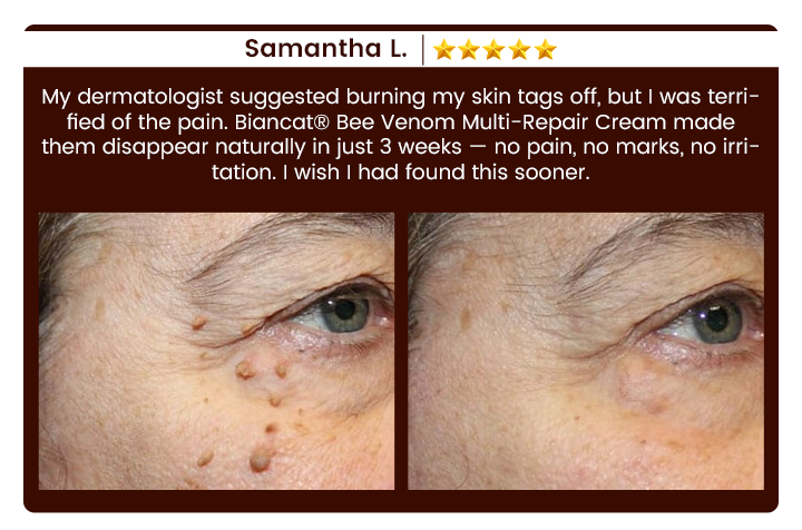 Biancat® Bee Venom Multi-Repair Cream