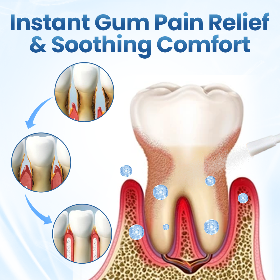 Nexisify® Gum Relief Natural Spray