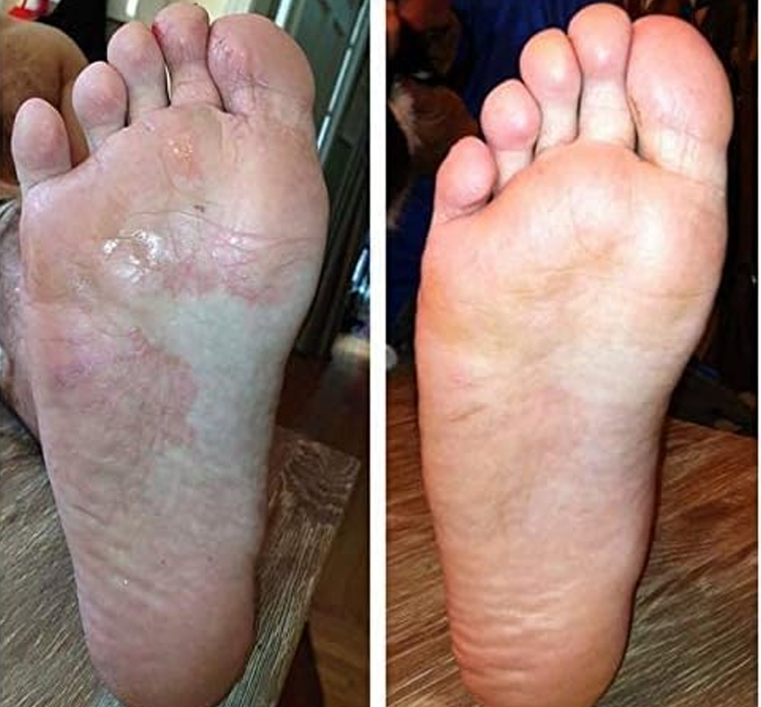 Biancat® AeroFilm Foot Defense Mist