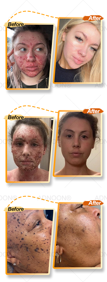 BBOJI™ 7-Day Multi-Effect All-in-One Skincare Cream image BBOJI™ 7-Day Multi-Effect All-in-One Skincare Cream