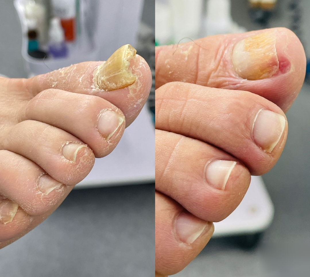 Biancat® AeroFilm Foot Defense Mist