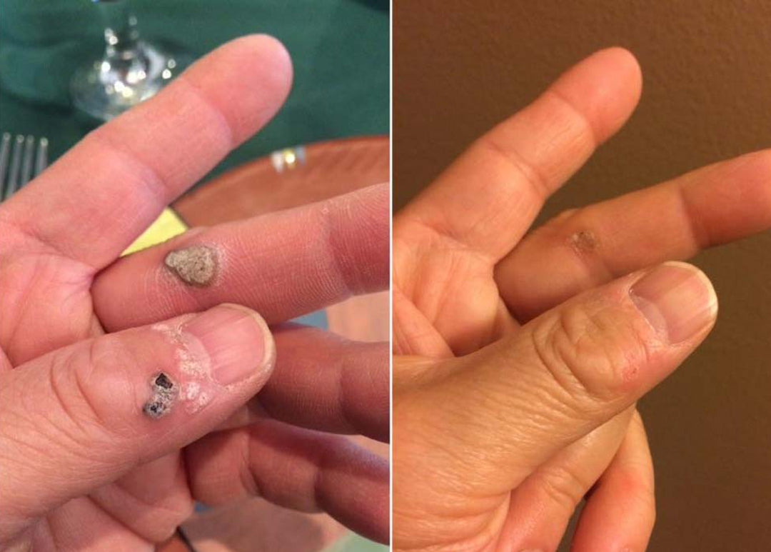 BQYOOM Dual-Action Renewal Cream