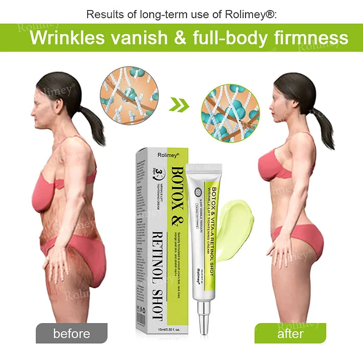 Rolimey® Botox & Vita-A Retinol Firming & Anti-Wrinkle Serum
