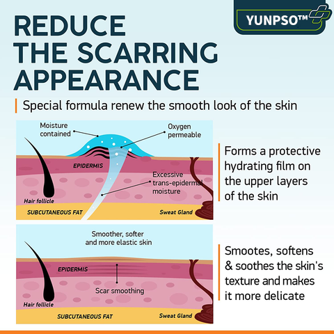 YUNPSO™ Advanced Scar Spray 22 3c8a3e95359f968dd5457825c85f5220