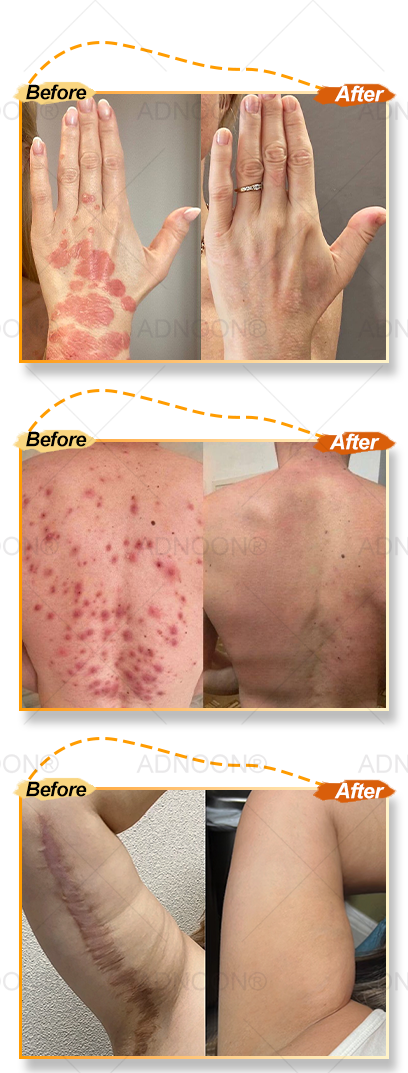 BBOJI™ 7-Day Multi-Effect All-in-One Skincare Cream image BBOJI™ 7-Day Multi-Effect All-in-One Skincare Cream