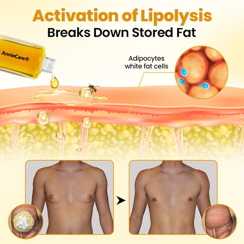 AnnieCare® ThermoFirm Bee Venom Gynecomastia-Oil 24 AnnieCare® ThermoFirm Bee Venom Gynecomastia-Oil