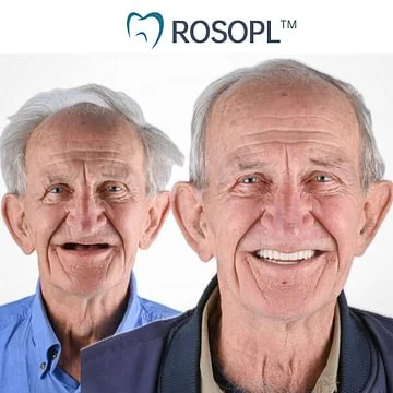 ROSOPL™ Functional Dentures – Dentist Recommended for Seniors 45+ | Made in USA | FDA Cleared