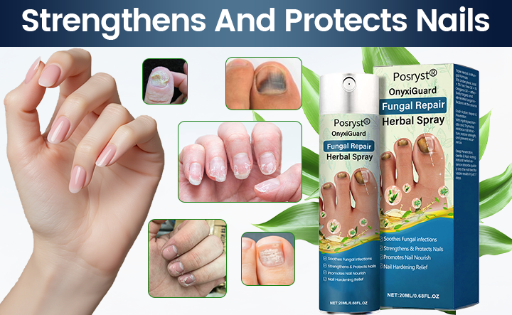 Posryst® OnyxiGuard Fungal Repair Herbal Spray