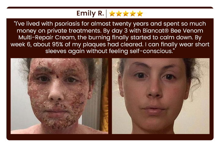 Biancat® Bee Venom Multi-Repair Cream