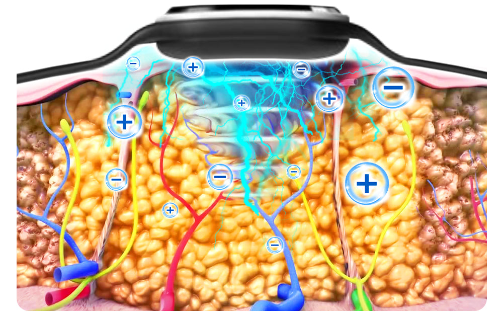 🧑‍⚕️NESLEMY™ Ultrasonic Fat Blasting and Detoxing Wristband B
