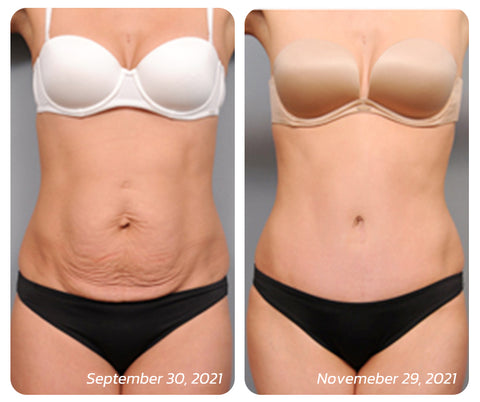 flysmus™ BeautyWomen Collagen Lifting Body Oil 39 4ced841c04449d67af6094335425878d