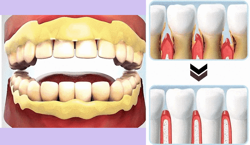 BQYOOM™ Teeth Restorative Mineral Powder image BQYOOM™ Teeth Restorative Mineral Powder