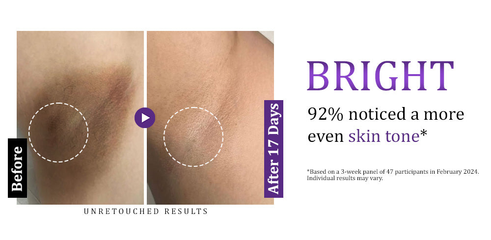 Furzero™ EPIGLOW MelanEX Advanced Cream