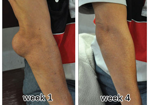 LAOZIK™ Turmeric & Emu Oil Arthritis Soothing Pain Relief Massage Gel Australian Osteopathic Association (AOA) Approved