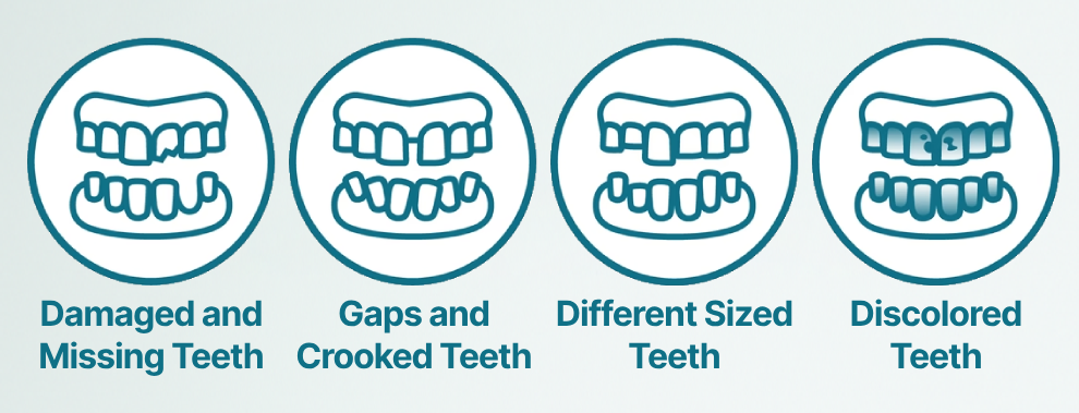 ROSOPL™-Advanced Custom-Fit Functional Dentures image ROSOPL™-Advanced Custom-Fit Functional Dentures