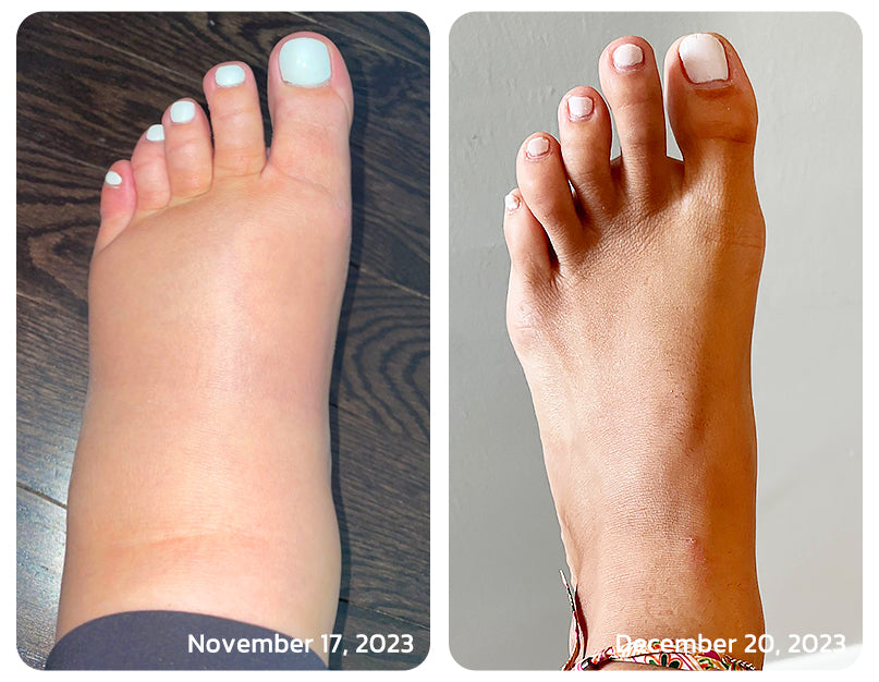 🧑‍⚕️NESLEMY™ Ultrasonic Fat Blasting and Detoxing Wristband B