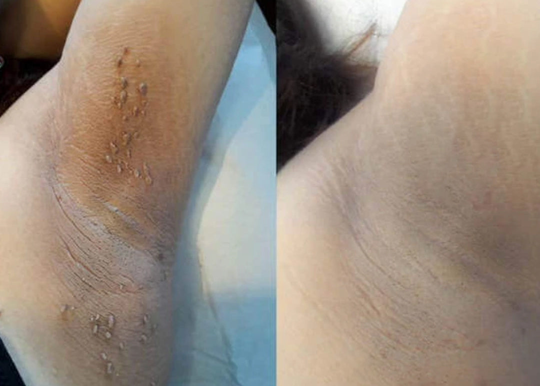 BQYOOM Dual-Action Renewal Cream