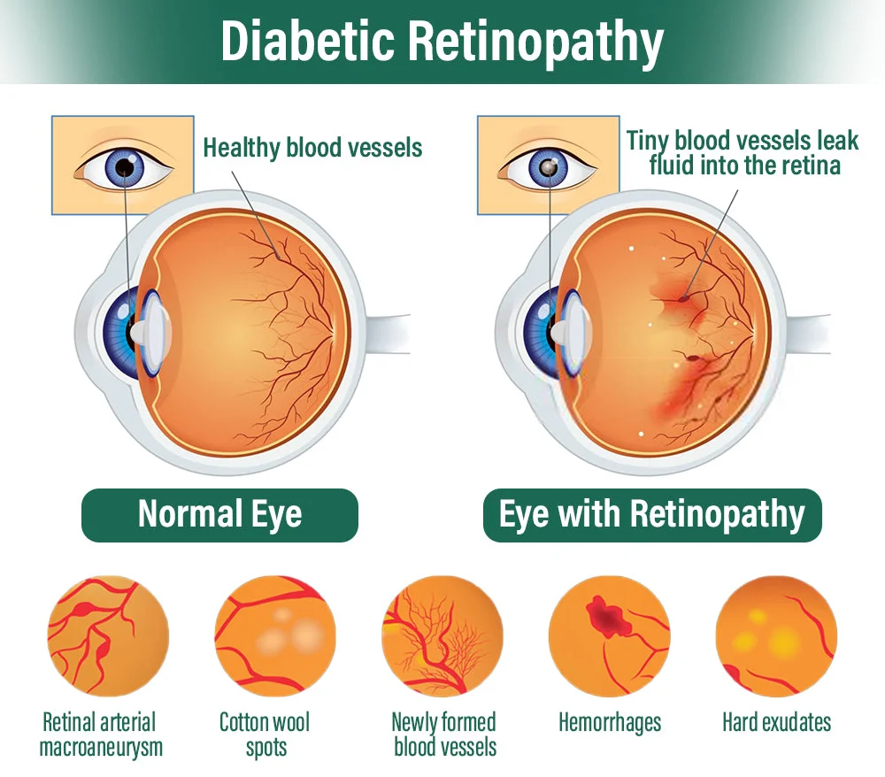 5a30bdf67da8ac98ab4d024ddd4fcf59