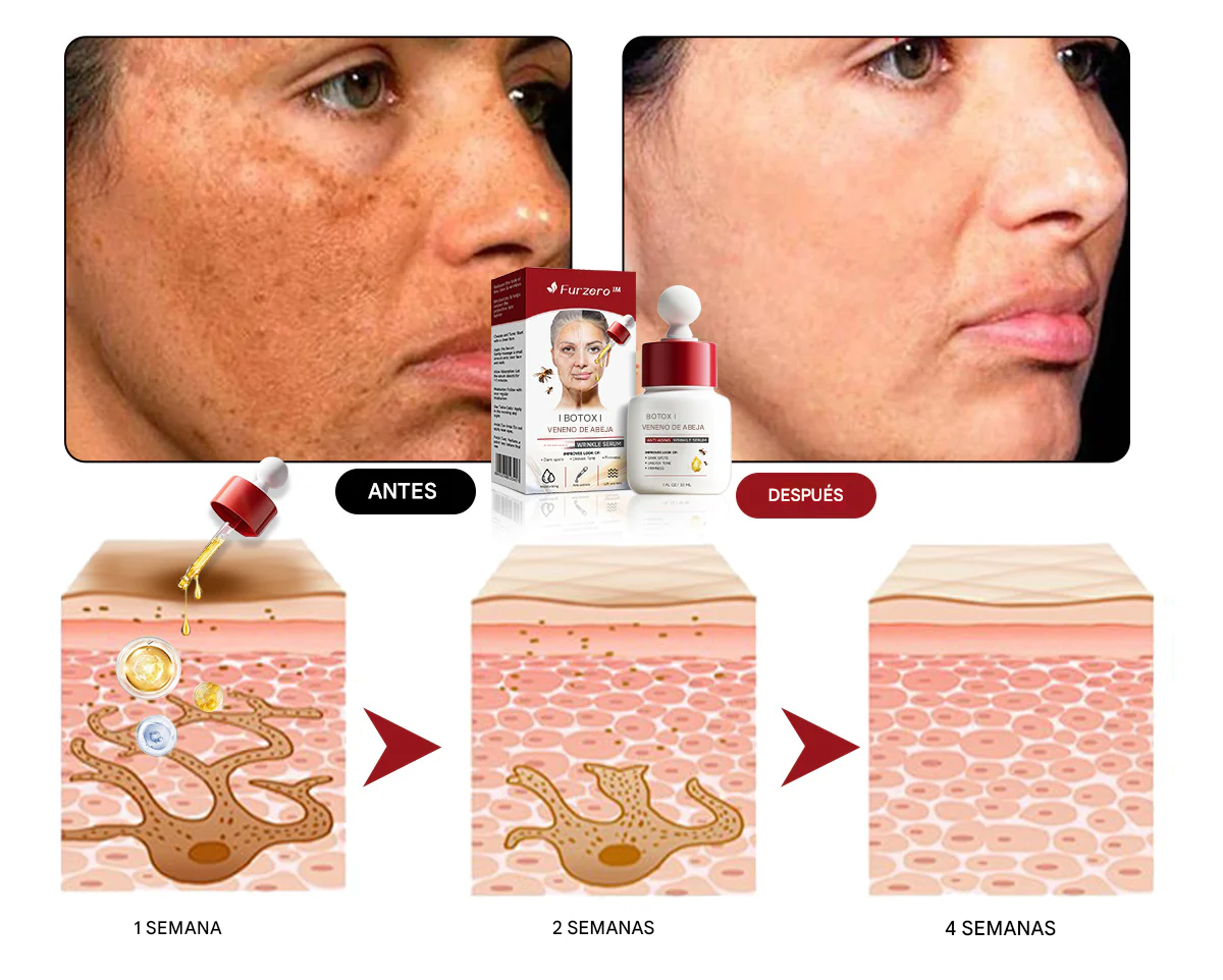 Furzero™ Botox anti-wrinkle serum with bee venom