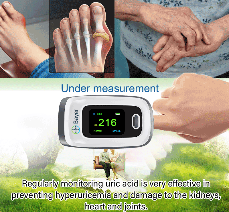 Prueba de ácido úrico.gif