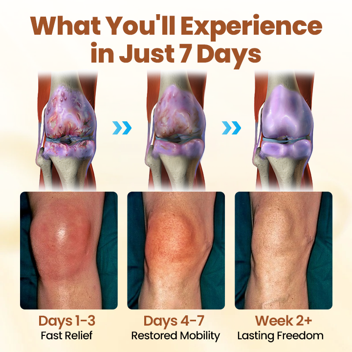 Caselast® Premium Curcumin Pain Relief Gel 30 Caselast® Premium Curcumin Pain Relief Gel