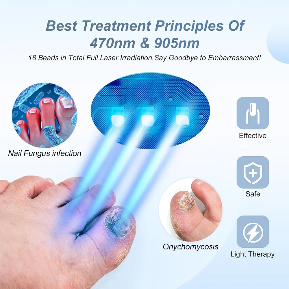 Nail Laser Fungus Device for Multiple Toenails & fingernails Nail Repair Solution for Damaged and Discolored Nails for Home Use