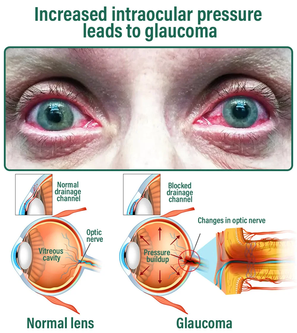 6256ddcab98fbdfcda053b5c1e2cd18b